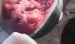 放疗可以吃牛角瓜,牛角瓜助力健康恢复